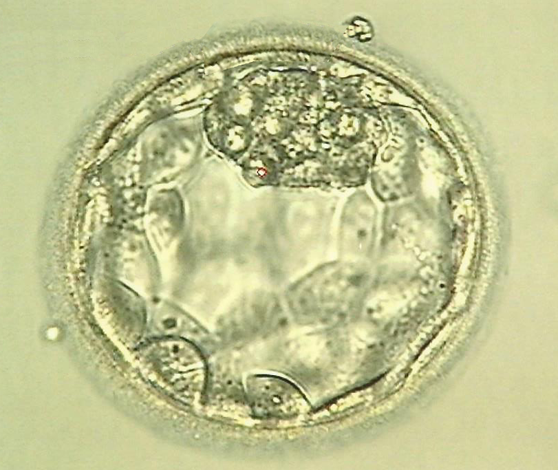 Day 6 Blastocyst